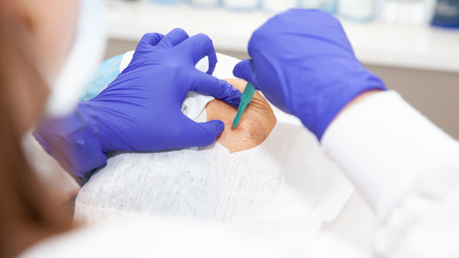 Liquid Biopsy