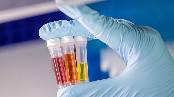 Top United States In Vitro Diagnostics Companies