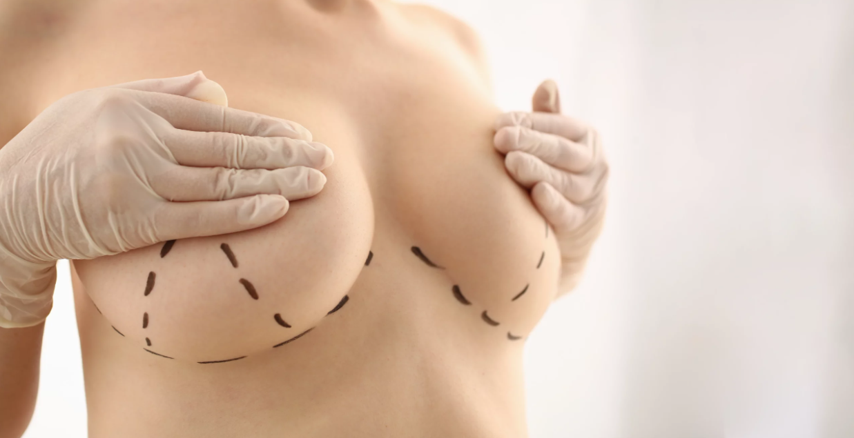 Top Mastopexy Companies