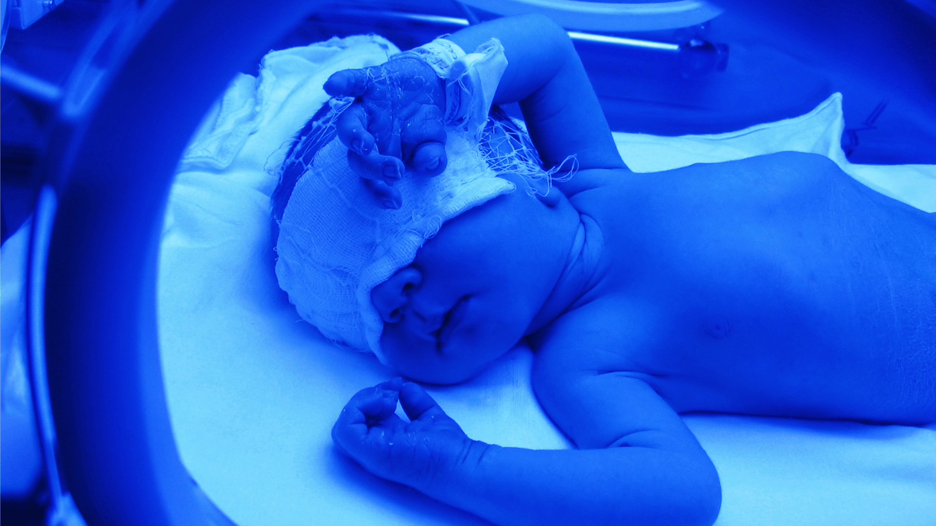 Top Infant Phototherapy Device Companies